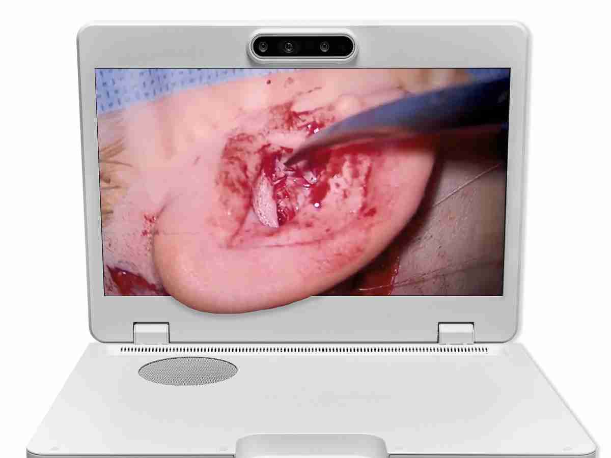 达擎之＂Heads-up 3D显微手术显示系统＂，，，，整合4K裸眼3D显示及眼球追踪系统，，，具备快速追踪人眼移动位置功能，，，，减轻医师长时间维持固定姿势的负担，，，让医师能有更宽广清晰的3D立体视野及更舒适的姿势来执行手术。。。。